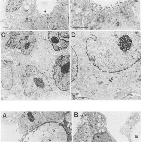 Transmission and scanning electron micrographs of HT-29 cells ...