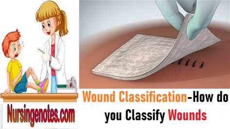 Wound Classification-How do you Classify Wounds . - NursingNotes