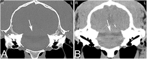 | Beam hardening artifact. Transverse computed tomography images of the... | Download Scientific ...