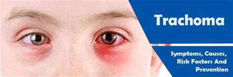 Trachoma- Symptoms, Causes, Risk Factors and Prevention