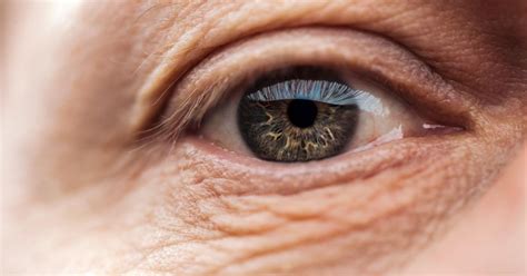 Important finding may help halt age-related macular degeneration