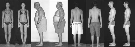 Rolfing-Before-and-After-Results | Certified Advanced Rolfer Corona Rolfing