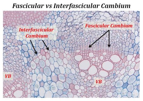 Fascicular and Interfascicular Cambium | EasyBiologyClass