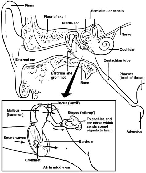 Can Glue Ear Come Back After Grommets at Christina Smith blog