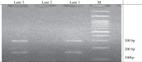 Representative PCR Products of T-ARMS-PCR Resolved by Agarose Gel ...