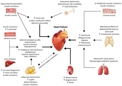 Obesity and heart attack | doctorvisit