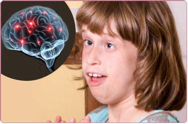 Rett Syndrome – Causes – Symptoms – Signs – Diagnosis - Treatment