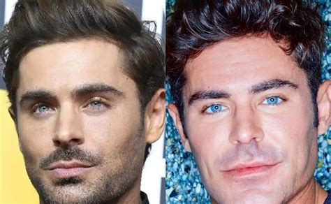 Zac Efron: ¿Botox, cirugía plástica?, el actor revela el motivo del ...