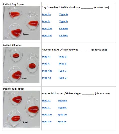 Solved Identify the Blood Types 1. Repeat the blood typing | Chegg.com