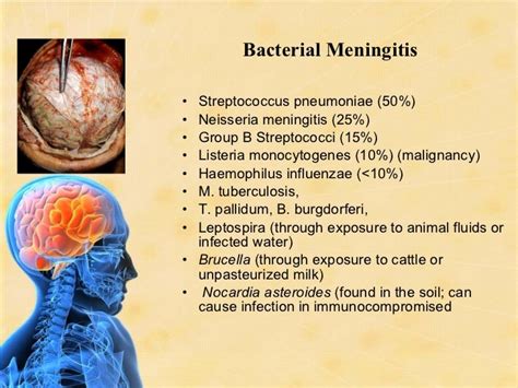 CNS Infections Siddiqui