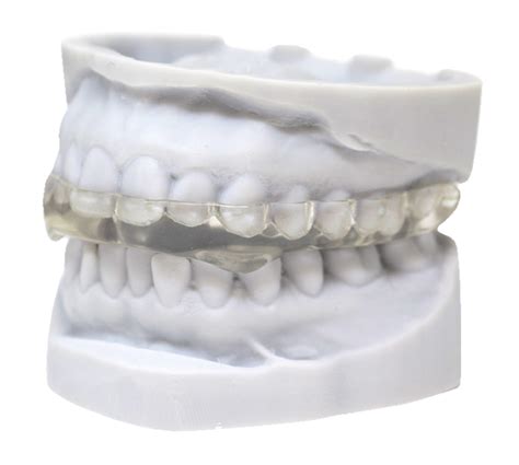 Hard Occlusal Splint RDL | Russellville Dental Lab