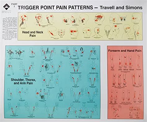 Trigger Point Pain Patterns – Free Patterns