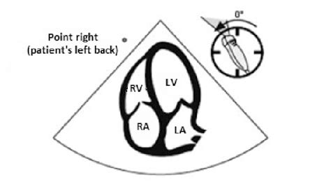 Apical 4-chamber view (adapted from http://www.fate-protocol.com/ with... | Download Scientific ...