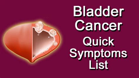 Bladder Cancer Quick Symptoms List - YouTube