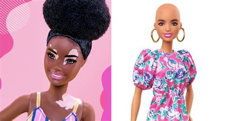 Barbie Expands Diverse Collection to Include Dolls with Vitiligo, Hair ...