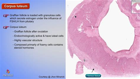Histology of Corpus luteum : Shotgun Histology - YouTube