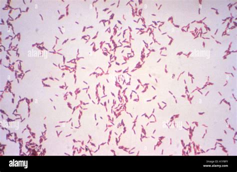 Actinomyces viscosus . Gram stain. Image courtesy CDC/Dr. W.A. Clark ...