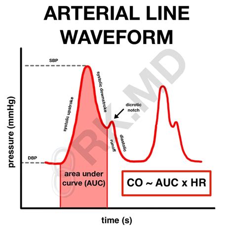 Pressure Transducers And Arterial Line Waveforms | RK.MD