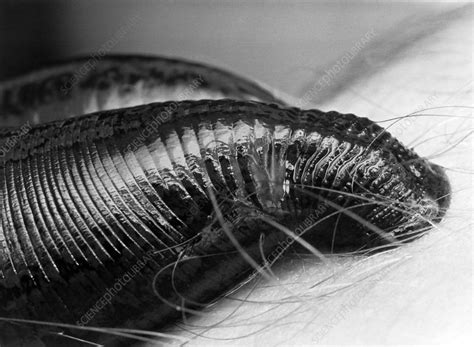 Medicinal leech sucking blood - Stock Image - Z205/0126 - Science Photo Library