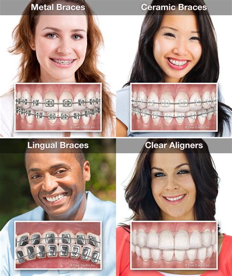 When to See an Orthodontist | Mountaineer Orthodontics | Bridgeport WV