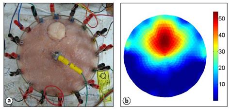 Electrical Impedance Tomography (EIT) System for Radiation-Free Medical ...