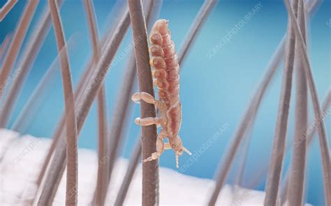 Head louse on a human head, illustration - Stock Image - F029/1149 - Science Photo Library