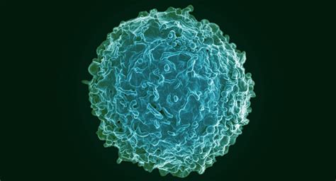 Immune Cells in Spinal Fluid of Multiple Sclerosis Patients Identified as Likely Disease Drivers ...