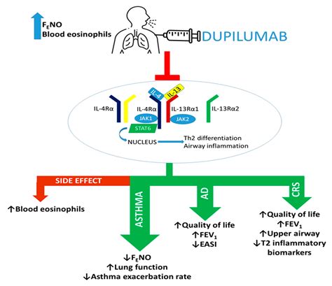 Biomedicines | Free Full-Text | The Role of Dupilumab in Severe Asthma