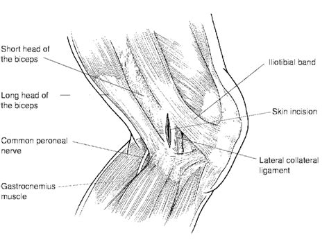 Basic Knee Anatomy