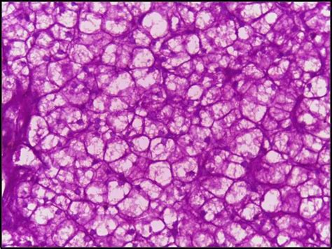 Periodic acid-Schiff (PAS) Staining: Principle, Procedure, and Application • Microbe Online