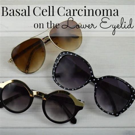 Basal Cell Carcinoma on the Lower Eyelid - Part 1 - Organized 31