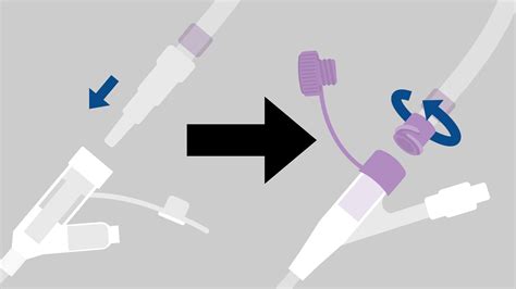 ENFit connectors are becoming the industry standard for safer tube feeding connections | Coram ...