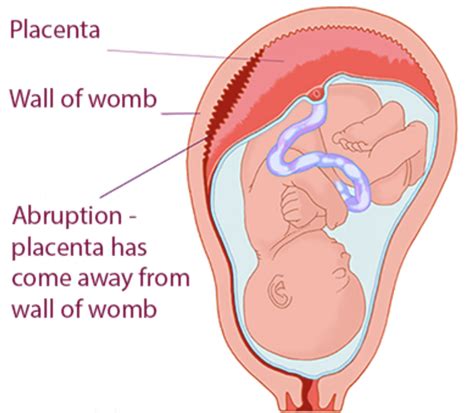 Problems – Patient Management and Assessment in Pregnancy