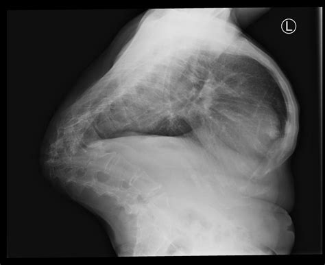 Viewing playlist: AAA-FEB_PIN | Radiopaedia.org | Radiology imaging ...