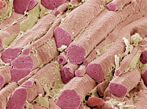 Human skeletal muscle fibers shown using a scanning electron micrograph ...