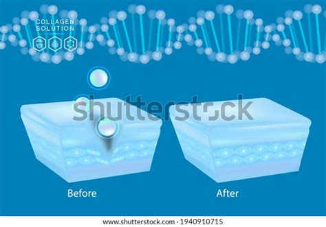 Hyaluronic Acid Before After Skin Solutions Stock Vector (Royalty Free ...