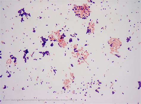 Gram stain demonstration slide, 1,000x 1 | Flickr - Photo Sharing!