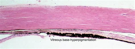 ANATOMY OF THE HUMAN EYE: Anatomy of the Eye- Vitreous Base