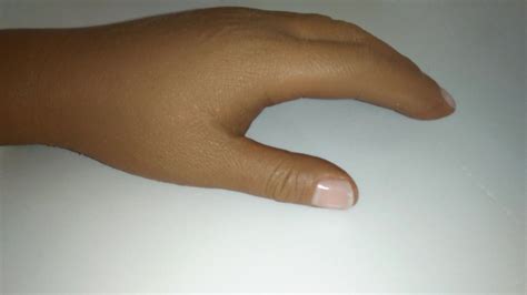 Prosthetic Silicone Cosmetic Hand Cover For Partial Hand Amputation ...