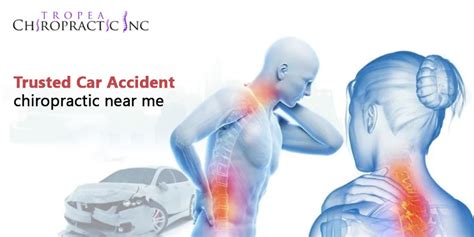 Find top car accident chiropractic care near you