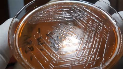 Proteus vulgaris- Introduction, Morphology, Pathogenicity, Lab Diagnosis