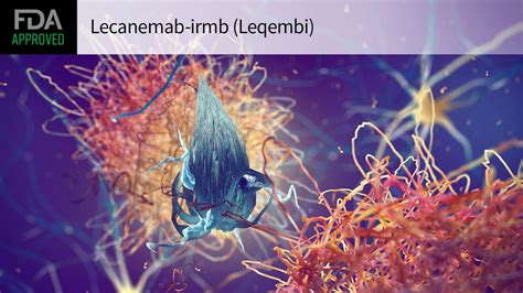 Alzheimer's Drug Lecanemab Wins FDA Approval | MedPage Today