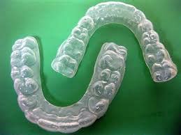 Orthodontic Retainer | O Connor Dental Health