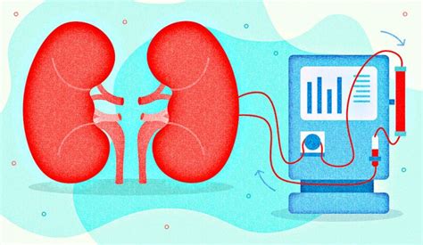 Kidney Dialysis: Types, Cost, Doctors, Hospitals & Best Dialysis Center ...