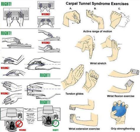 how to prevent CARPAL TUNNEL SYNDROME in our age of computers | Carpal ...