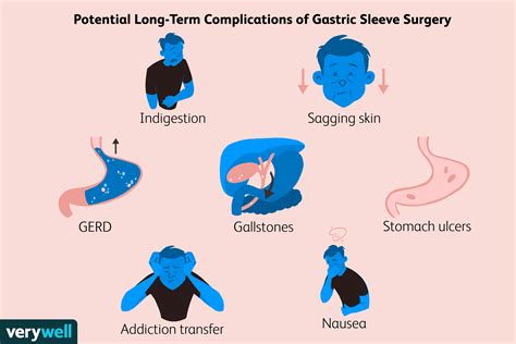 10 Years After Gastric Sleeve: Long-Term Success