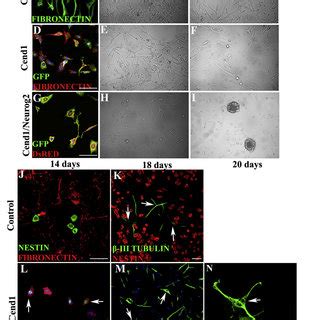 MEF Culture Shift to Induced Neural Precursor Cell Culture and Neuronal... | Download Scientific ...