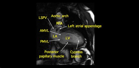 MRI BLOG: Cardiac Anatomy