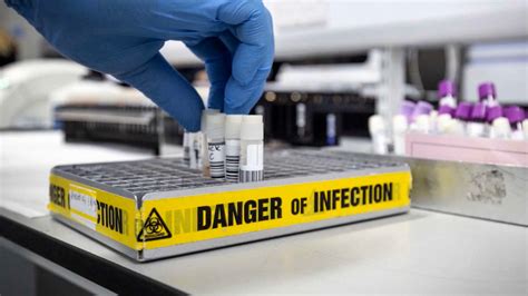 CDC to warn some travelers to watch for Marburg virus symptoms