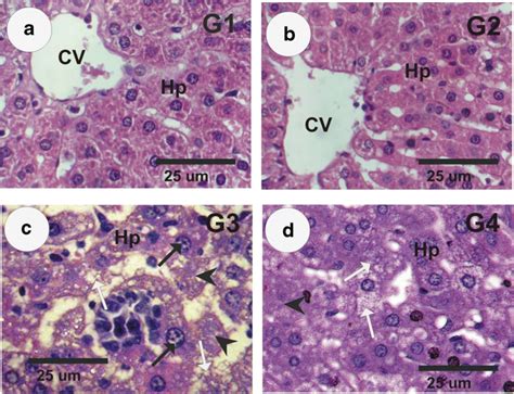 Photomicrographs of mice liver sections of different groups stained... | Download Scientific Diagram